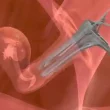 Embryo Transfer