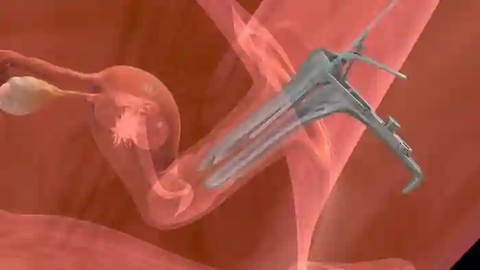 Embryo Transfer