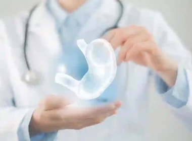Bariatric Surgery