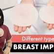 breast implants