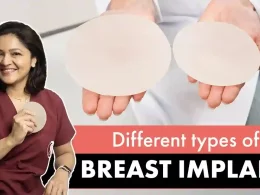 breast implants