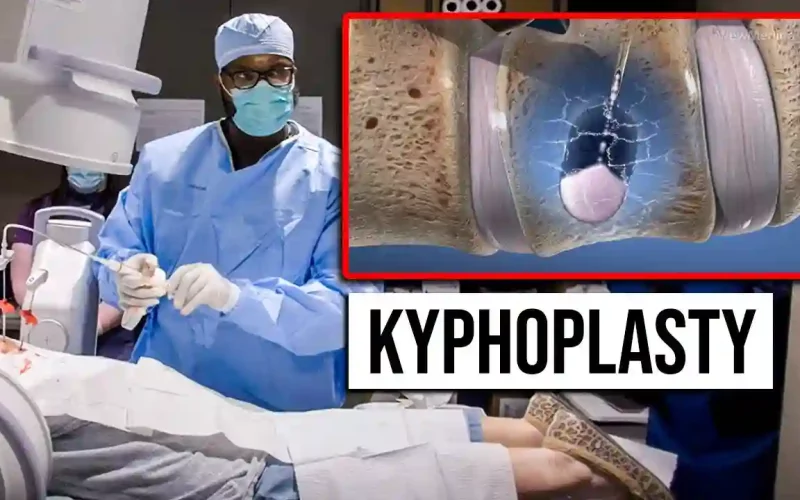 kyphoplasty chandler